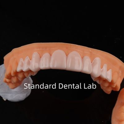 Wysoka estetyka stomatologiczna w uszy w standardowym laboratorium stomatologicznym