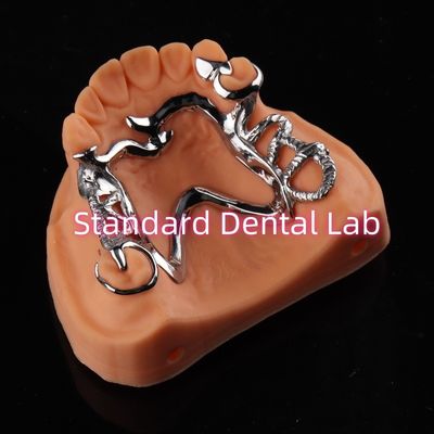 Kobalt Chrome Framework Ni Be Free zdejmowalna proteza zębowa China Dental Lab