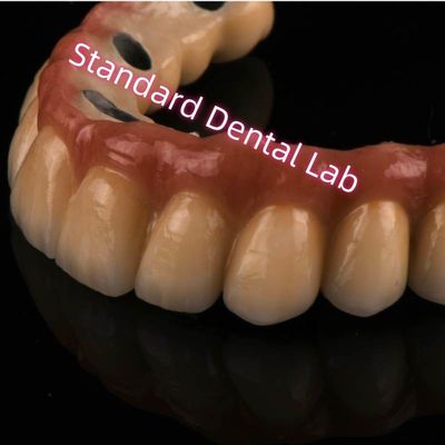 Cobalt Chrome Ivoclar Laser Sintered PFM Crown Metal Porcelan Bridge A1 A2 A3