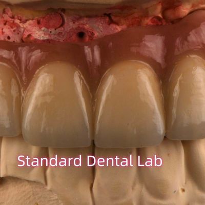 CAD CAM Fresowanie PFM Porcelana niedrogocenna stopiona do metalu
