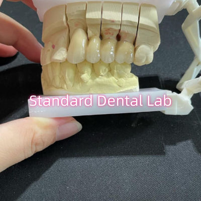 Odlewane PFM Nieszlachetne CoCr Metal Porcelan Bridge Dental CCM