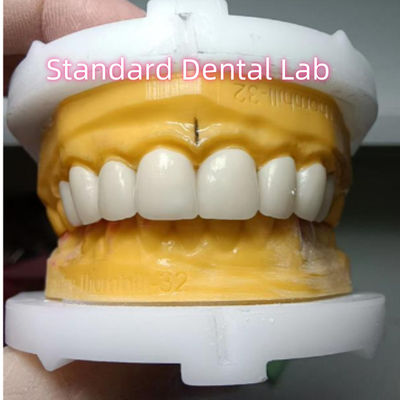 Ivoclar Zirconia Crown Veneers Wysoka przejrzystość Estetyka