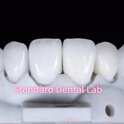 Naturalnie wyglądające odbudowy zębowe Aidite Zirconia