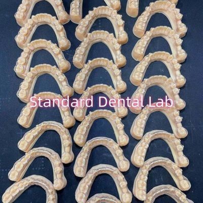 Profesjonalny plan leczenia zębów ortodontycznych Invisalign Clear Retainers