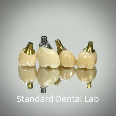 Profesjonalny Zirconia Screw Retained Implant Crown Titanium CAD CAM