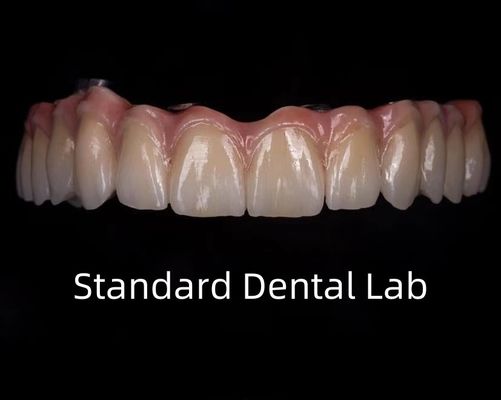 Titanium pełne Zirconia most Translucency dentystyczny na sztabu implantu