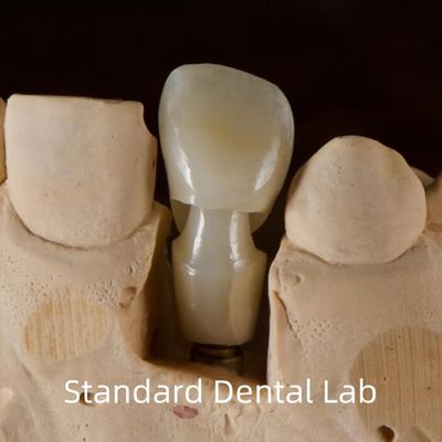 Implant stomatologiczny Tibase Zirconia Abutment Titanium Dokładność dostosowana