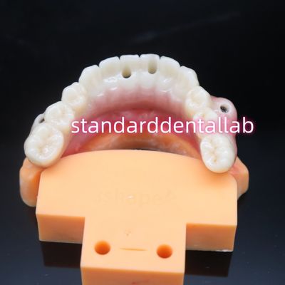 Biokompatybilny most z implantami dentystycznymi w kolorze cyrkoniowym