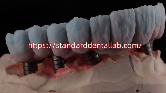 Implant wspierany Zirkonia most z titanu abutment wysokiej estetyki