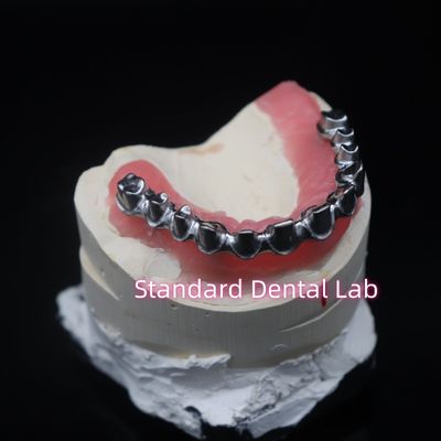 Całkowity łuk Malo most Restauracja zębów Zirconia Korony z gumą Poecelian China Dental Lab