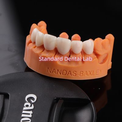 Komfort i funkcjonalność z cyfrowym CAD CAM Dental Lab Przejrzystości powłoki Zirconia most