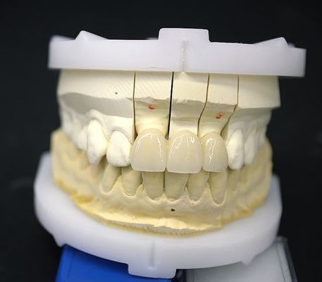 Precyzyjny Zirconia Crown Bridge Komfortowe dopasowanie / estetyka 3-4 dni Szybki czas realizacji