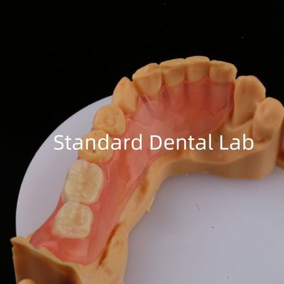 Zęby Ace Pink/Dark TCS Valplast Flexible Parcial Dentures for High Aesthetics Dental 3D Print Model