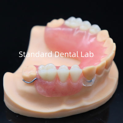 Wysoka estetyka akrylowa częściowa proteza z przejrzystym zamkiem i akrylowymi zębami China Dental Lab