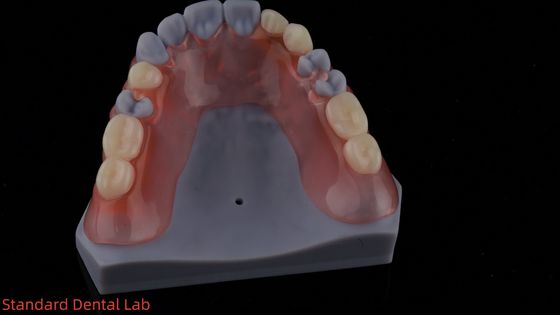 Model drukowany w 3D Wysoka estetyka stomatologiczna TCS Valplast elastyczne protezy częściowe Laboratorium stomatologiczne