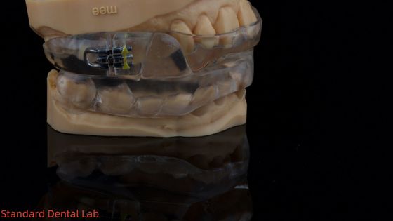 Zastosowalny urządzenie do snu grzbietowego urządzenie anty chrapanie dla spokojnego snu China Dental Lab