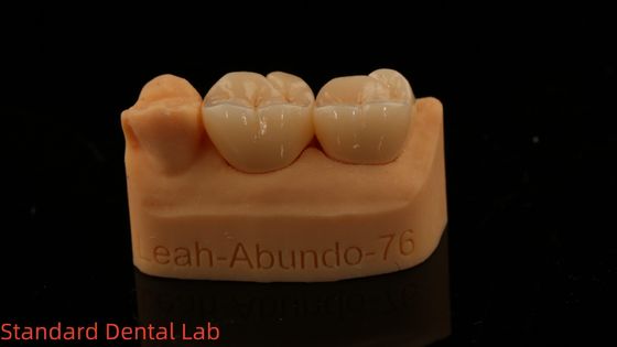 Kolorowe korony zębowe 3D Pro Wysokiej Przejrzystości pełne korony z cyrkonia z 5-letnią gwarancją