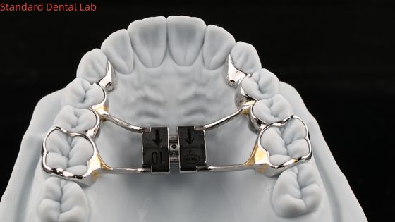 Archy Zęby Rozszerzacz podniebienia Stabilny Hyrax Rozszerzacz podniebienia Doskonałe dopasowanie SDL Dental Lab Ortodontics Appliance