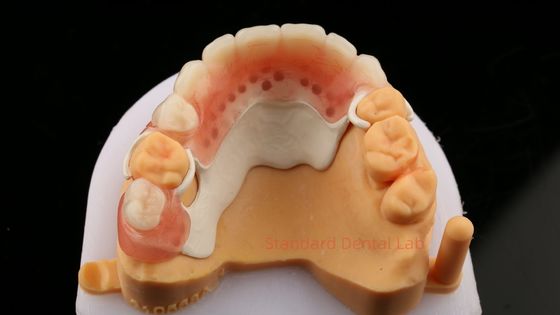 Peek Częściowe ramy projektowania ISO CE And FDA Dental Lab Akrylowe Częściowe ramy protezy