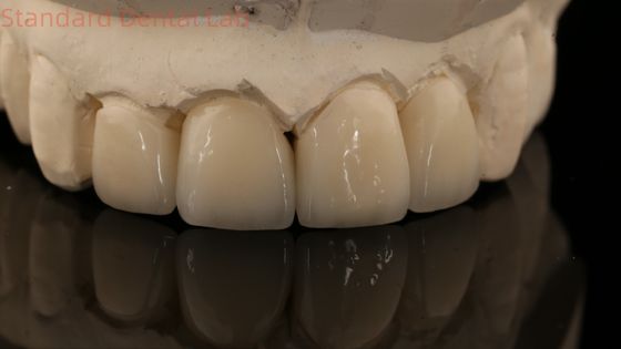 Silna warstwa Zirkonia Korona i most w dobrej estetyce Zirkonia warstwa China Dental Lab