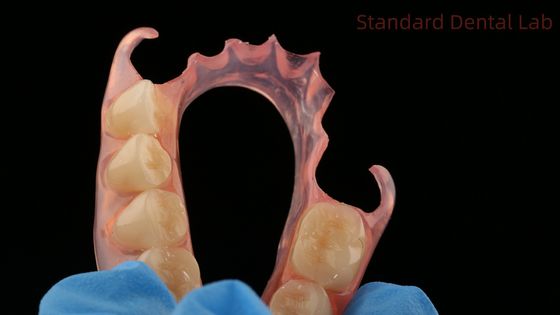 Stomatologiczny TCS Valplast Elastyczne zęby częściowe Laboratorium stomatologiczne Model druku 3D Wysoka estetyka