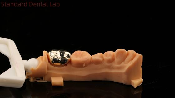 Wysoki Noble Żółty Złoty Korony Zęba Profesjonalny Ni Bądź Wolny ISO I FDA zatwierdzone China Dental Laboratory