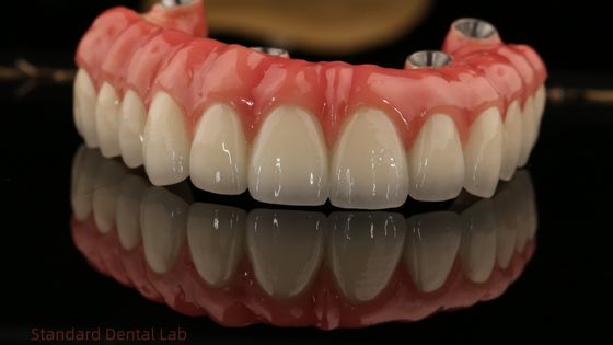 Całkowity łuk Zirconia Implanty most Zirconia Crown Vita Shade Niestandardowe wszystkie na cztery / sześć implantów dentystycznych