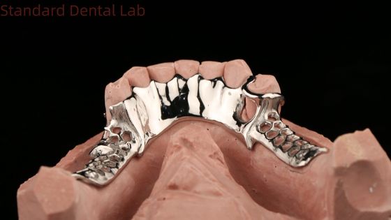 Kobaltowy chromowy ramy metalowe częściowe protezy z dolnym fartuchem Design SDL Dental Lab