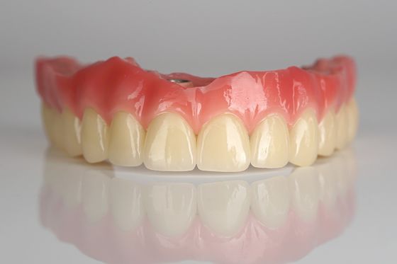 Całkowity łuk Zirconia Implant Bridge All-on-Four / All-on-Six Implantów Zębowych Szybkie wyzdrowienie