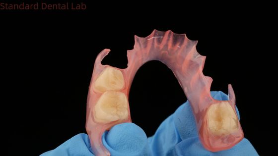 Drukowanie 3D Modelu Stomatologicznego TCS Valplast Elastyczne Częściowe Zęby Różowe / Ciemne Kolory Produkt z Laboratorium Stomatologicznego