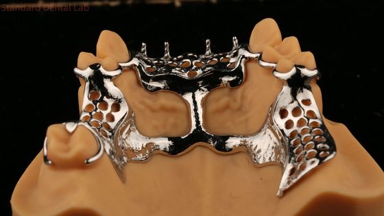 Górne ramy odlewane Metalowe części zębów akrylowych Silne lekkie i trwałe