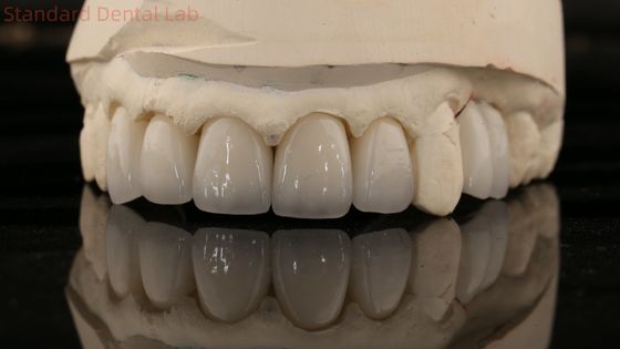 Chińskie laboratorium stomatologiczne Zirkonia pełna korona wysokiej estetyki naturalny most stomatologiczny 5 lat gwarancji