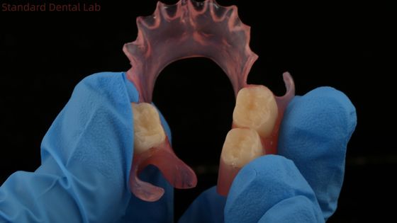 Zębowe TCS Valplast Elastyczne zęby częściowe Nesbit Valplast Finish China Dental Lab Valplast Clap