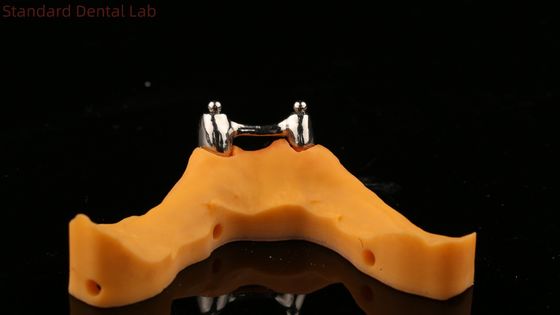 Ivoclar Digital Dental Implant Bar Denture z dodatkami, pełne akrylowe tytanowe protezy z implantami