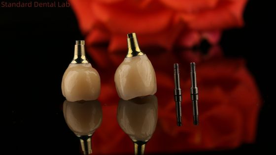 Porcelan Zirkonia Cement Implant z zainstalowaną śrubą W kształcie sześciokątnej głowy dla estetyki dostosowanej do potrzeb