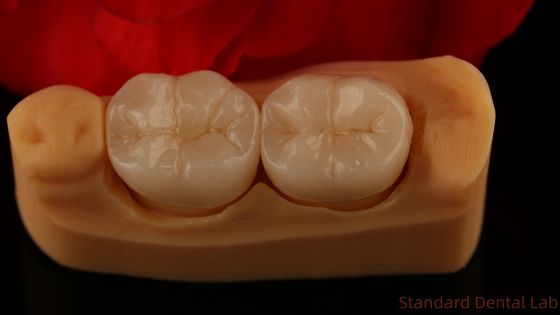 Pełny kontur Zirconia Korona Wyjątkowa wytrzymałość i estetyka Bez porcelanowej nakładki Korona tylna China Dental Lab