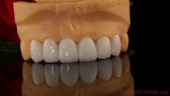 Całkowity Kontur Zirkonia korony przezroczystość 3D PRO bez porcelanowej nakładki Standardowe laboratorium stomatologiczne
