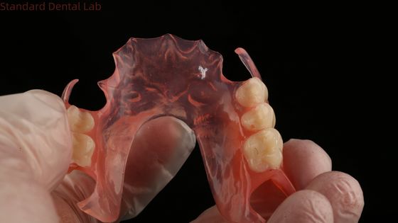 Zęby Ace Pink/Dark TCS Valplast Flexible Parcial Dentures for High Aesthetics Dental 3D Print Model