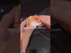 Wysoka estetyka akrylowa częściowa proteza z przejrzystym zamkiem i akrylowymi zębami China Dental Lab