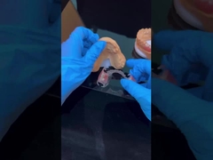 Jasne ramy Akrylowy Metal Częściowe ramy protezy Wysoka estetyka Chińskie laboratorium stomatologiczne