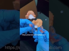 FDA Kobalt Chrom Wysokiej estetycznej jasnej ramy Częściowe