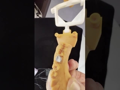 Korona z cyrkonu o pełnym konturze/wysoce estetyczna, naturalna, dostosowana do potrzeb