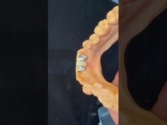 Zęby dentystyczne PFM Maryland Bridge Wysoka estetyka Certyfikat FDA