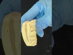 Korona z cyrkonu o pełnym konturze/wysoce estetyczna, naturalna, dostosowana do potrzeb