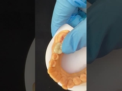 Wytrzymałość Emax Ceramic Veneers Crown z doskonałą odpornością na plamy / biokompatybilnością