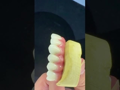 Korona implantów dentystycznych