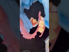 Model drukowany w 3D Wysoka estetyka stomatologiczna TCS Valplast elastyczne protezy częściowe Laboratorium stomatologiczne